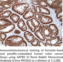 SATB2 (C-Term) Rabbit Monoclonal Antibody (Clone RM365)