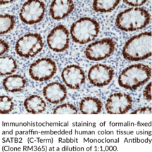 SATB2 (C-Term) Rabbit Monoclonal Antibody (Clone RM365)