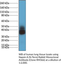 Napsin A (N-Term) Rabbit Monoclonal Antibody (Clone RM366) (Kidney-derived Aspartic Protease-like Protein, NAPA, Napsin A Aspartic Peptidase, Napsin-1)