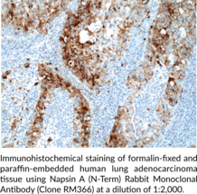 Napsin A (N-Term) Rabbit Monoclonal Antibody (Clone RM366)