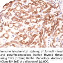 TPO (C-Term) Rabbit Monoclonal Antibody (Clone RM368)
