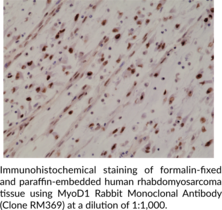 MyoD1 Rabbit Monoclonal Antibody (Clone RM369)