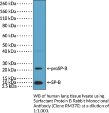 Surfactant Protein B Rabbit Monoclonal Antibody (Clone RM370) (SP-B)