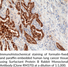Surfactant Protein B Rabbit Monoclonal Antibody (Clone RM370)