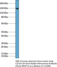 CD163 (N-Term) Rabbit Monoclonal Antibody (Clone RM371)