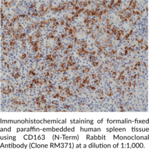 CD163 (N-Term) Rabbit Monoclonal Antibody (Clone RM371)