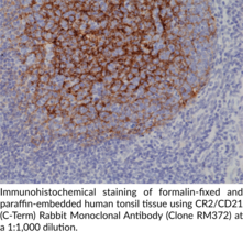 CR2/CD21 (C-Term) Rabbit Monoclonal Antibody (Clone RM372)