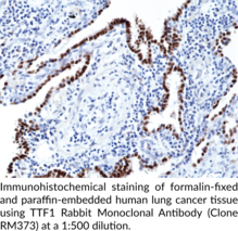 TTF1 Rabbit Monoclonal Antibody (Clone RM373)