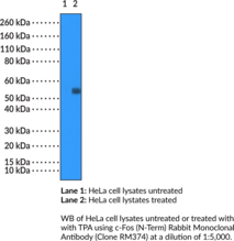 c-Fos (N-Term) Rabbit Monoclonal Antibody (Clone RM374) (Cellular Oncogene Fos, Proto-oncogene c-Fos)