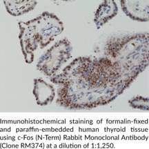 c-Fos (N-Term) Rabbit Monoclonal Antibody (Clone RM374)