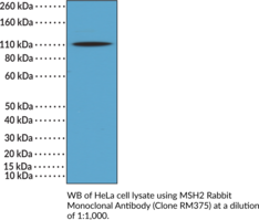 MSH2 Rabbit Monoclonal Antibody (Clone RM375)