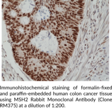 MSH2 Rabbit Monoclonal Antibody (Clone RM375)