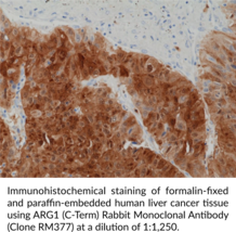 ARG1 (C-Term) Rabbit Monoclonal Antibody (Clone RM377)