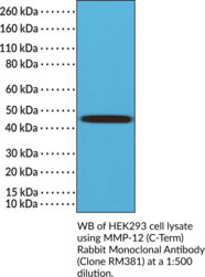 MMP-12 (C-Term) Rabbit Monoclonal Antibody (Clone RM381) (Macrophage Elastase, Matrix Metalloproteinase-12, MME)