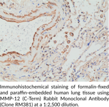MMP-12 (C-Term) Rabbit Monoclonal Antibody (Clone RM381)