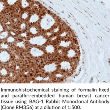 BAG-1 Rabbit Monoclonal Antibody (Clone RM356)