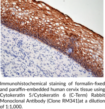 Cytokeratin 5/Cytokeratin 6 (C-Term) Rabbit Monoclonal Antibody (Clone RM341)