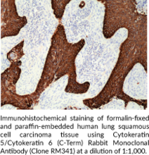 Cytokeratin 5/Cytokeratin 6 (C-Term) Rabbit Monoclonal Antibody (Clone RM341)