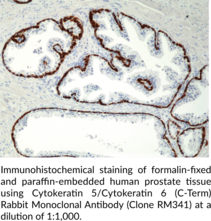 Cytokeratin 5/Cytokeratin 6 (C-Term) Rabbit Monoclonal Antibody (Clone RM341)