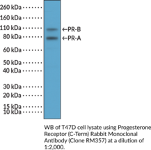 Progesterone Receptor (C-Term) Rabbit Monoclonal Antibody (Clone RM357) (NR3C3, Nuclear Receptor Subfamily 3 Group C Member 3)