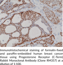 Progesterone Receptor (C-Term) Rabbit Monoclonal Antibody (Clone RM357)