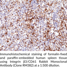 Integrin β3/CD61 Rabbit Monoclonal Antibody (Clone RM382)