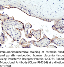 Transferrin Receptor Protein 1/CD71 Rabbit Monoclonal Antibody (Clone RM384)