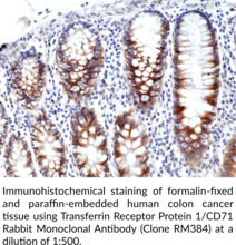 Transferrin Receptor Protein 1/CD71 Rabbit Monoclonal Antibody (Clone RM384)