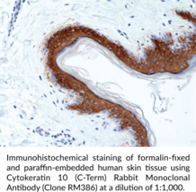 Cytokeratin 10 (C-Term) Rabbit Monoclonal Antibody (Clone RM386)