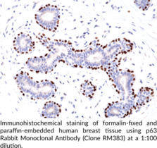 p63 Rabbit Monoclonal Antibody (Clone RM383)