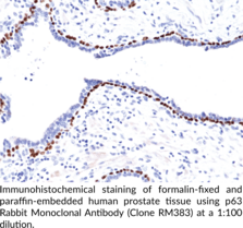 p63 Rabbit Monoclonal Antibody (Clone RM383)