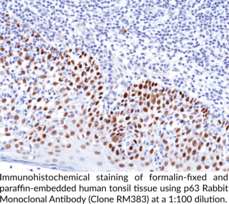 p63 Rabbit Monoclonal Antibody (Clone RM383)