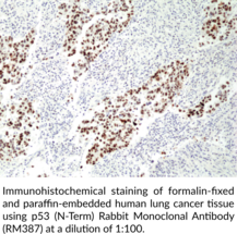 p53 (N-Term) Rabbit Monoclonal Antibody (RM387)
