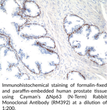 ΔNp63 (N-Term) Rabbit Monoclonal Antibody (RM392) (p40)