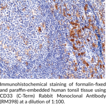 CD33 (C-Term) Rabbit Monoclonal Antibody (RM398)