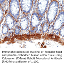 Caldesmon (C-Term) Rabbit Monoclonal Antibody (RM396)