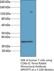 CD8a (C-Term) Rabbit Monoclonal Antibody (RM397) (T Cell Surface Glycoprotein CD8 α-chain, T Cell Surface Glycoprotein CD8 Alpha Chain)