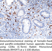 CD8a (C-Term) Rabbit Monoclonal Antibody (RM397)