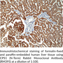 CPS1 (N-Term) Rabbit Monoclonal Antibody (RM395)