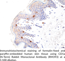 CD1a (N-Term) Rabbit Monoclonal Antibody (RM393)