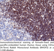 CD1a (N-Term) Rabbit Monoclonal Antibody (RM393)