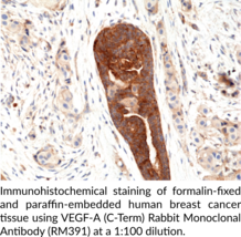 VEGF-A (C-Term) Rabbit Monoclonal Antibody (RM391)
