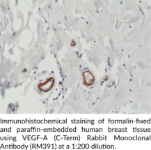 VEGF-A (C-Term) Rabbit Monoclonal Antibody (RM391)
