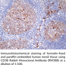CD38 Rabbit Monoclonal Antibody (RM388)
