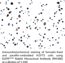EGFRL858R Rabbit Monoclonal Antibody (RM380)