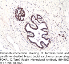 FOXP1 (C-Term) Rabbit Monoclonal Antibody (RM402)