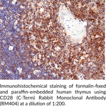 CD28 (C-Term) Rabbit Monoclonal Antibody (RM404)