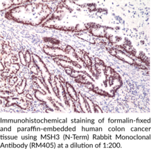 MSH3 (N-Term) Rabbit Monoclonal Antibody (RM405)