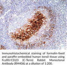 FcεRII/CD23 (C-Term) Rabbit Monoclonal Antibody (RM406)