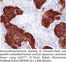 p16INK4A (C-Term) Rabbit Monoclonal Antibody (Clone RM409)